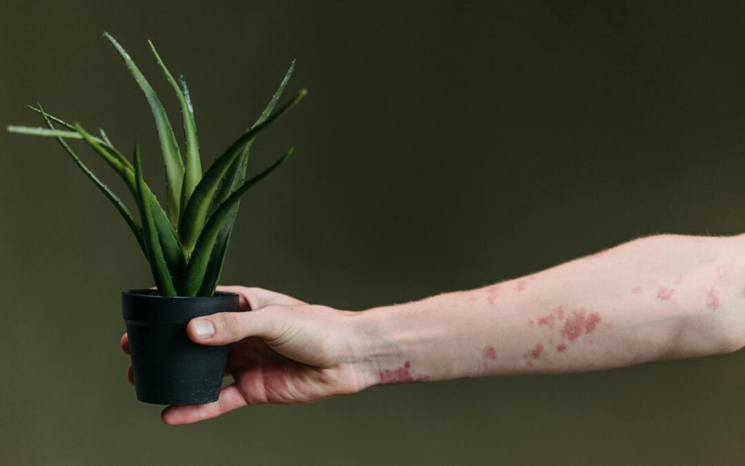 L’eczéma chez le nourrisson : Comprendre les causes et traiter avec une approche naturopathique